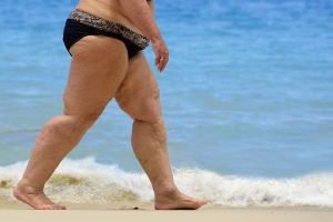 photo of obese woman walking on the beach | chafing