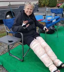 Benefits of Treatment | photo of Denise with bandages on legs