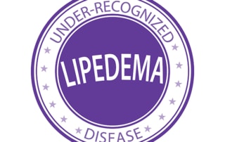 Misconceptions about lipedema