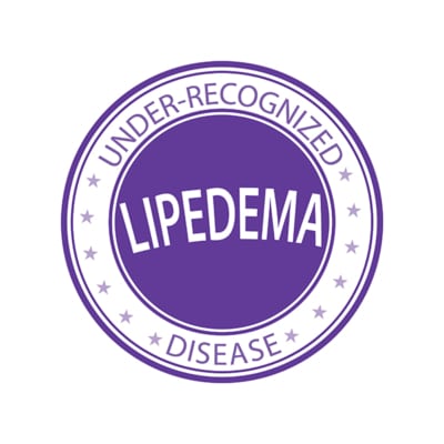 Misconceptions about lipedema