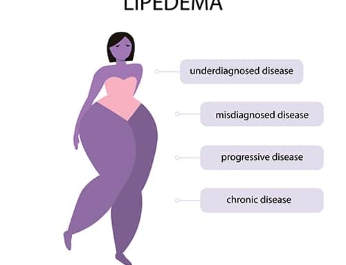 The Main Causes of Lipedema